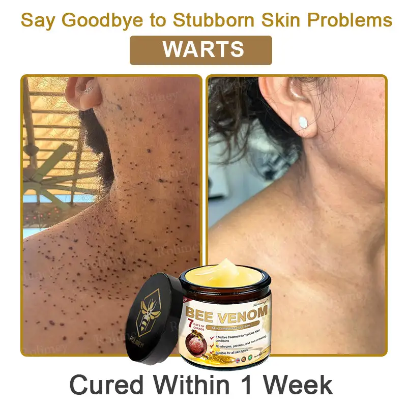 Rolimey® Bee Venom Skin Comprehensive Cream