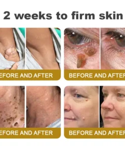 Rolimey® Bee Venom Skin Comprehensive Cream