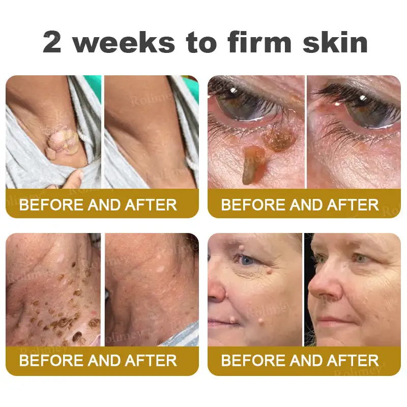 Rolimey® Bee Venom Skin Comprehensive Cream