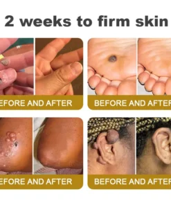 Rolimey® Bee Venom Skin Comprehensive Cream