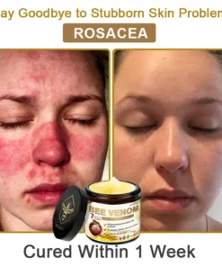 Rolimey® Bee Venom Skin Comprehensive Cream