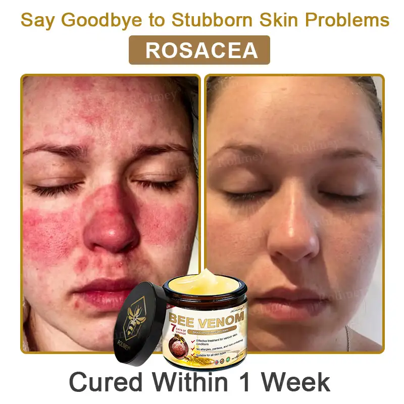 Rolimey® Bee Venom Skin Comprehensive Cream