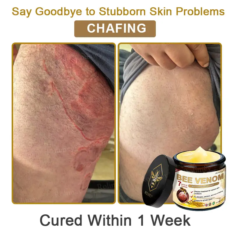 Rolimey® Bee Venom Skin Comprehensive Cream