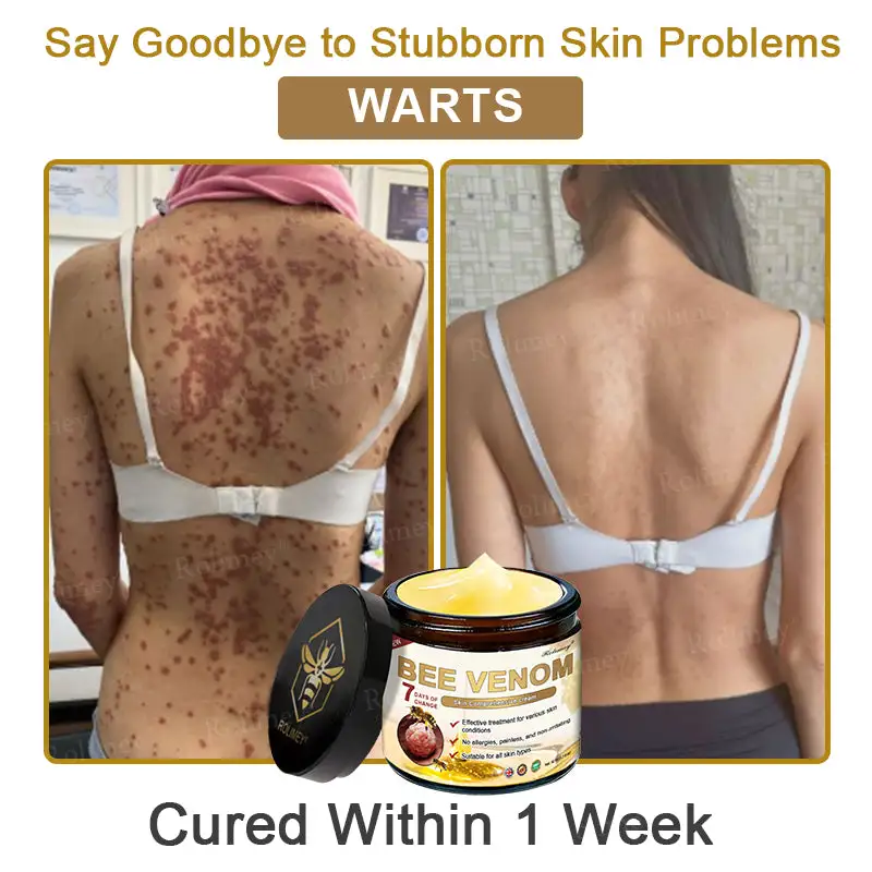 Rolimey® Bee Venom Skin Comprehensive Cream
