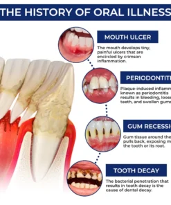 Rolimey® BeeTakt Bee Venom Dental Treatment Drops Mouthwash