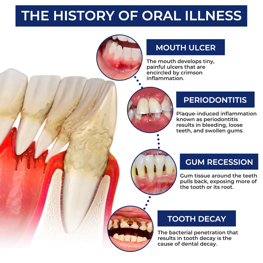 Rolimey® BeeTakt Bee Venom Dental Treatment Drops Mouthwash