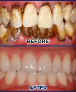 Rolimey® BeeTakt Bee Venom Dental Treatment Drops Mouthwash