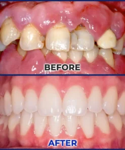 Rolimey® BeeTakt Bee Venom Dental Treatment Drops Mouthwash