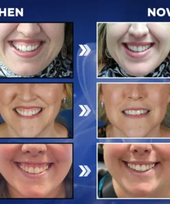 Rolimey® BeeTakt Bee Venom Dental Treatment Drops Mouthwash