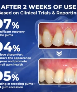 Rolimey® BeeTakt Bee Venom Dental Treatment Drops Mouthwash