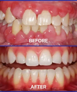 Rolimey® VioCore Bee Venom Dental Treatment Toothpaste