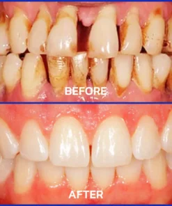 Rolimey® VioCore Bee Venom Dental Treatment Toothpaste