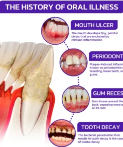 Rolimey® VioCore Bee Venom Dental Treatment Toothpaste
