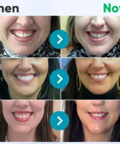 Rolimey® VioGloss Bienengift-Zahntherapie Oral Power