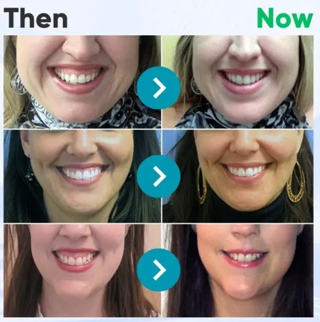 Rolimey® VioGloss Bienengift-Zahntherapie Oral Power