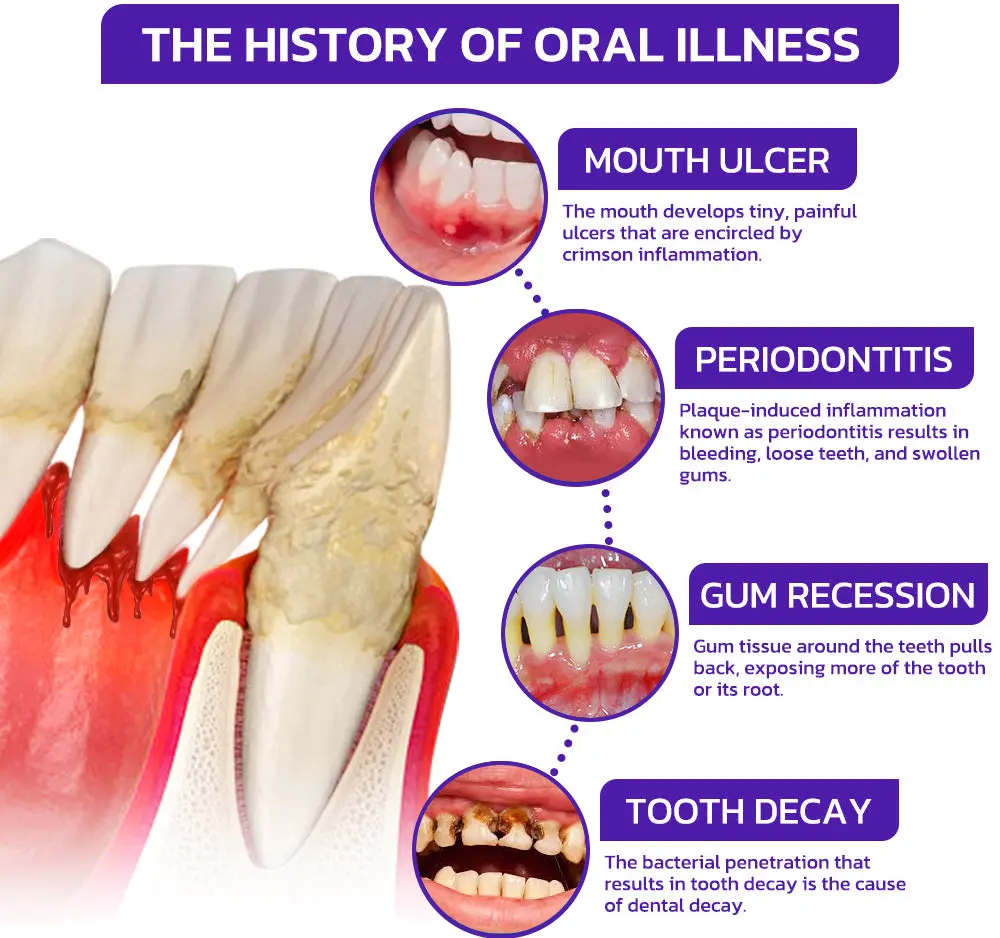 Rolimey® VioGloss Bienengift-Zahntherapie Oral Power