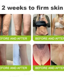 Rolimey® Botox Vita-A Retinol Shot Wrinkle-Lift Tightening cream - Last Day Promotion 50 OFF