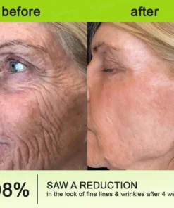 Rolimey® Botox Vita-A Retinol Wrinkle-Lift Cream Made Shipped from CA