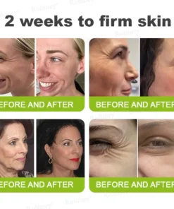 Rolimey® Botox Vita-A Retinol Wrinkle-Lift Cream Made Shipped from CA