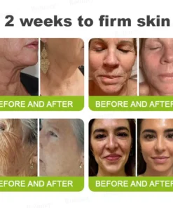 Rolimey® Botox Vita-A Retinol Wrinkle-Lift Cream Made Shipped from CA