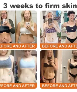 Rolimey® Bee Venom Advanced Skin Rescue