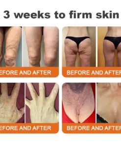 Rolimey® Bee Venom Advanced Skin Rescue