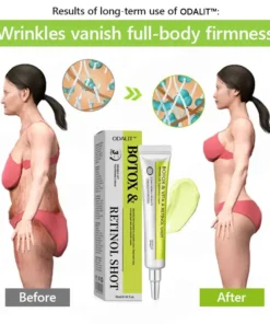 Rolimey® Botox-Lift Vita-A Retinol Shot Professional Anti-Aging Breakthrough (Made in AU ) 50 OFF - LAST 24 HOURS