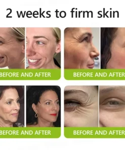 Rolimey® Botox-Lift Vita-A Retinol Shot Professional Anti-Aging Breakthrough (Made in AU ) 50 OFF - LAST 24 HOURS