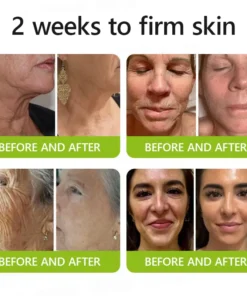 Rolimey® Botox-Lift Vita-A Retinol Shot Professional Anti-Aging Breakthrough (Made in AU ) 50 OFF - LAST 24 HOURS