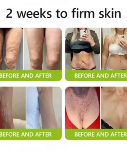 Rolimey® Botox-Lift Vita-A Retinol Shot Professional Anti-Aging Breakthrough (Made in AU ) 50 OFF - LAST 24 HOURS