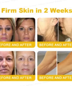 Rolimey® Botox Stem Cell Retinol Wrinkle-Lift Cream