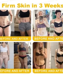 Rolimey® Botox Stem Cell Retinol Wrinkle-Lift Cream