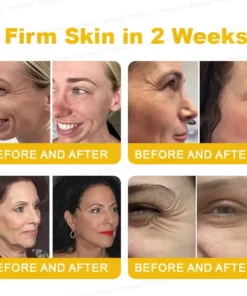 Rolimey® Botox Stem Cell Retinol Wrinkle-Lift Cream