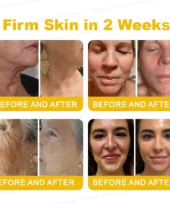 Rolimey® Botox Stem Cell Retinol Wrinkle-Lift Cream