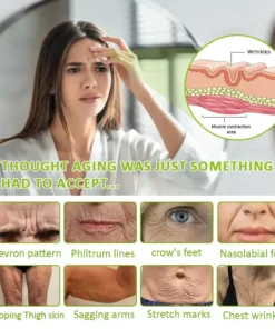 Rolimey® Botox Vita-A Retinol Shot Wrinkle-Lift Tightening Cream, Last Day Promotion 70 OFF