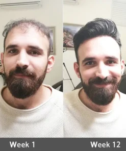 Rolimey® Highly Effective Biotin & Rosemary Hair Growth Serum