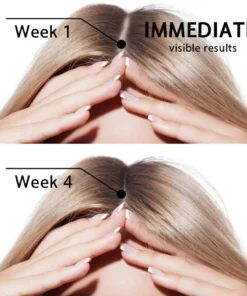 Rolimey® Highly Effective Biotin & Rosemary Hair Growth Serum