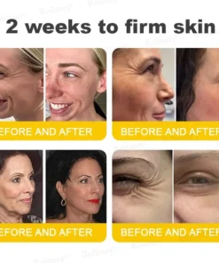 Rolimey® Botox & Vita A Retinol Shot Tightening Cream