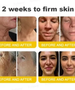 Rolimey® Botox & Vita A Retinol Shot Tightening Cream