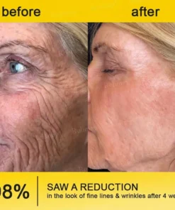 Rolimey® Botox & Vita A Retinol Shot Tightening Cream