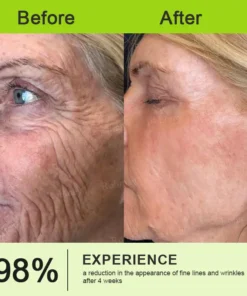 Rolimey® Botox & Vita-A Retinol Shot Wrinkle-Lift Tightening stick