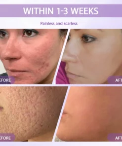 Rolimey® Anti-aging & Spot-repair Serum