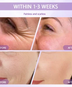 Rolimey® Anti-aging & Spot-repair Serum