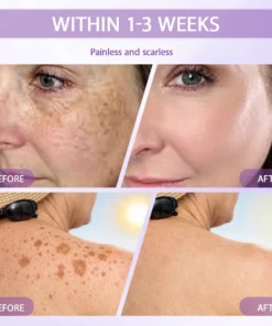 Rolimey® Anti-aging & Spot-repair Serum