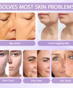 Rolimey® Anti-aging & Spot-repair Serum