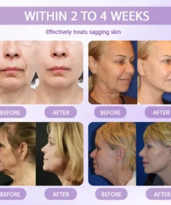 Rolimey® Anti-aging & Spot-repair Serum