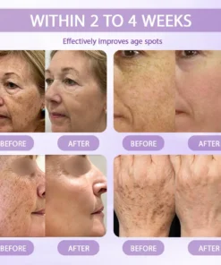 Rolimey® Anti-aging & Spot-repair Serum