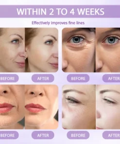 Rolimey® Anti-aging & Spot-repair Serum