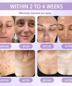 Rolimey® Anti-aging & Spot-repair Serum