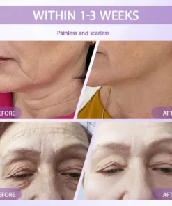 Rolimey® Anti-aging & Spot-repair Serum